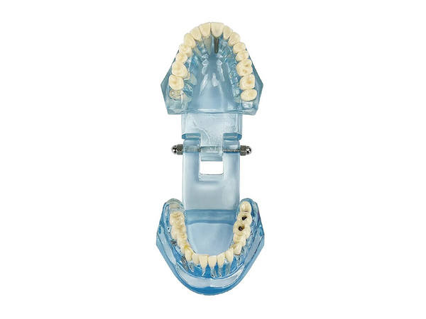 Model stomatologiczny szczęka zęby zębow implanty